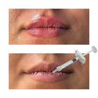 Injections non chirurgicales de lèvre d'acide hyaluronique de remplisseurs d'amélioration de lèvre