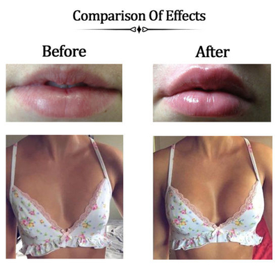 Acide hyaluronique de remplissage croisé Gel croisé - hyaluronate de sodium cliniquement prouvé