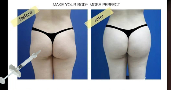 Remplisseur injectable de sein d'acide hyaluronique de Subskin SubQ pour l'augmentation de pénis de fesses
