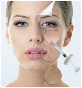 la croix de 1ml 1.1ml a lié les remplisseurs cutanés d'acide hyaluronique pour la joue de Midface de nez