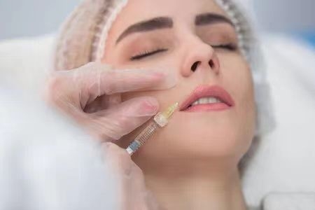 Emballage de la seringue Acide hyaluronique pour les rides Remplisseur de nez, gel d'acide hyaluronique pour injection
