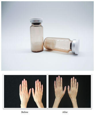 Le gel injectable de remplissage cutané à l'acide hyaluronique permet une sculpture faciale précise et une texture de peau lisse pour les professionnels