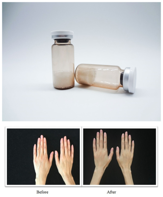 Injectable PLLA Acide hyaluronique pCL PDRN Remplisseur cutané facial Pour la production de collagène Traitement des rides