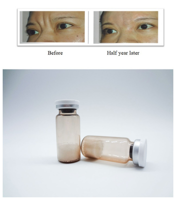 Injectable PLLA Poly-L-acide lactique Remplisseur cutané Éliminer les rides du visage Stimuler la régénération du collagène