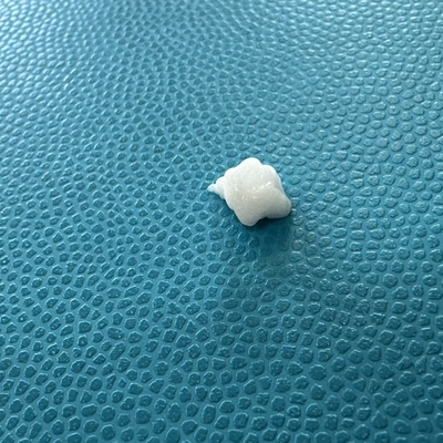 Effect de remplissage avancé sur les lignes de marionnettes avec l'injection de calcium hydroxyapatite