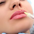 Le remplisseur lié croisé d'acide hyaluronique de gel pour des lèvres font face à l'injection de fesses de sein