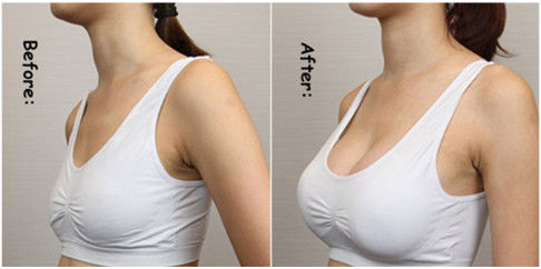Acide hyaluronique injectable Pour les lèvres, le visage, les rides, l' agrandissement du sein, les fesses, les injections