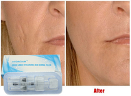 Remplisseur injectable 10ml d'acide hyaluronique pour des joues Chin Augmentation d'injection de lèvre