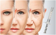 Acide hyaluronique anti-vieillissement du propulseur 2ml Polycaprolactone de peau du lifting PCL