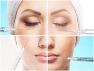 L'injection faciale d'acide hyaluronique de sodium de remplisseur de ride gélifient les remplisseurs injectables pour le visage