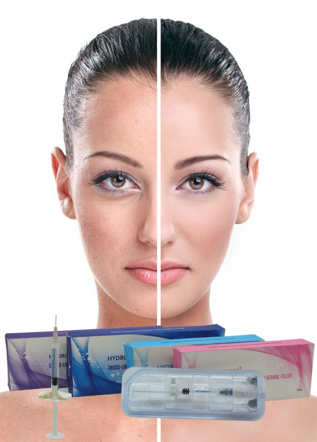Remplisseur de rides professionnel 24 mg/ml Acide hyaluronique pour le visage Hyaluronate de sodium lié croisé Injectable