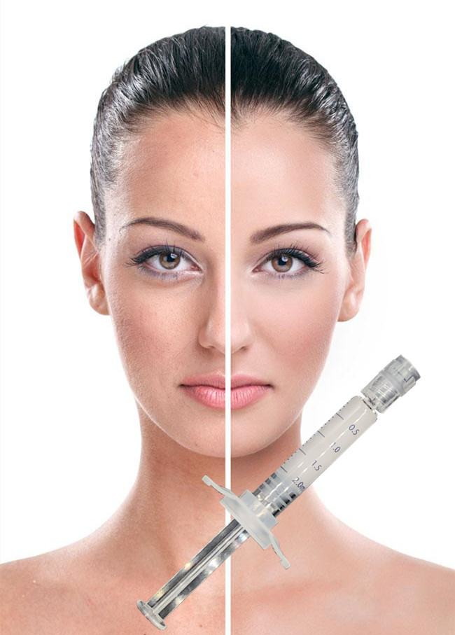 Soins de la peau cutanés de remplisseur du lifting PCL se soulevant serrant le collagène stimulant