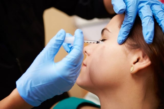 Gel d'acide hyaluronique injection de remplissage en hydroxylapatite de calcium pour augmentation du menton et définition de la mâchoire